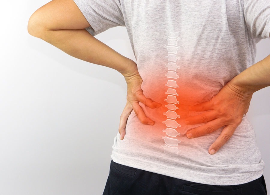 Bel Kayması (Spondilolistezis) Günlük Hayatı Zorlaştırabiliyor Bel kayması, omurga sağlığını